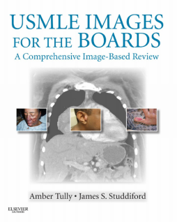 USMLE Images for the Boards E-Book USMLE Images for the Boards E-Book