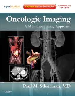 Oncologic Imaging: A Multidisciplinary Approach E-Book Oncologic Imaging: A Multidisciplinary Approach E-Book
