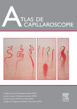 Atlas de capillaroscopie Atlas de capillaroscopie