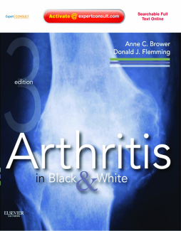 Arthritis in Black and White E-Book Arthritis in Black and White E-Book