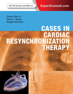 Cases in Cardiac Resynchronization Therapy E-Book Cases in Cardiac Resynchronization Therapy E-Book