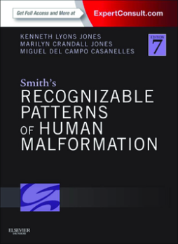 Smith's Recognizable Patterns of Human Malformation E-Book Smith's Recognizable Patterns of Human Malformation E-Book