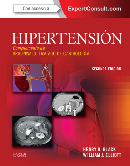 Hipertensión + ExpertConsult Hipertensión + ExpertConsult