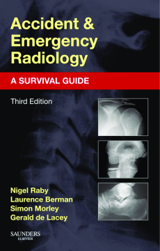 Accident and Emergency Radiology: A Survival Guide E-Book