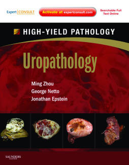 Uropathology E-Book Uropathology E-Book