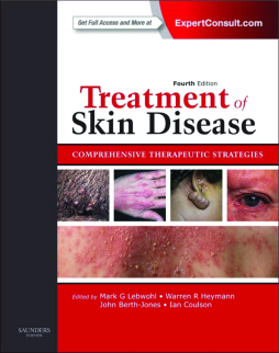 Treatment of Skin Disease E-Book Treatment of Skin Disease E-Book