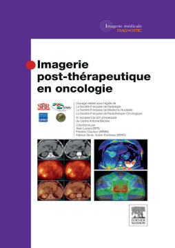 Imagerie post-thérapeutique en oncologie Imagerie post-thérapeutique en oncologie
