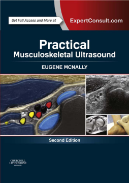 Practical Musculoskeletal Ultrasound E-Book Practical Musculoskeletal Ultrasound E-Book