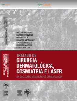 Tratado de Cirurgia Dermatológica, Cosmiatria e Laser da SBD- Tratado de Cirurgia Dermatológica, Cosmiatria e Laser da SBD-