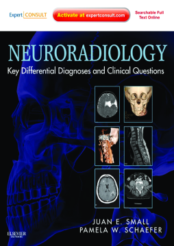 Neuroradiology: Key Differential Diagnoses and Clinical Questions E-Book Neuroradiology: Key Differential Diagnoses and Clinical Questions E-Book