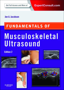 Fundamentals of Musculoskeletal Ultrasound E-Book Fundamentals of Musculoskeletal Ultrasound E-Book