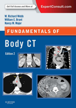 Fundamentals of Body CT E-Book Fundamentals of Body CT E-Book