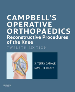 Campbell's Operative Orthopaedics: Reconstructive Procedures of the Knee E-Book Campbell's Operative Orthopaedics: Reconstructive Procedures of the Knee E-Book