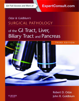 Odze and Goldblum Surgical Pathology of the GI Tract, Liver, Biliary Tract and Pancreas E-Book Odze and Goldblum Surgical Pathology of the GI Tract, Liver, Biliary Tract and Pancreas E-Book