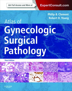 Atlas of Gynecologic Surgical Pathology E-Book Atlas of Gynecologic Surgical Pathology E-Book