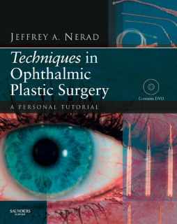 Techniques in Ophthalmic Plastic Surgery - E-Book Techniques in Ophthalmic Plastic Surgery - E-Book