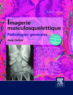 Imagerie musculosquelettique : pathologies générales Imagerie musculosquelettique : pathologies générales
