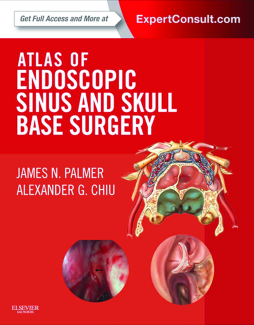 Atlas of Endoscopic Sinus and Skull Base Surgery E-Book Atlas of Endoscopic Sinus and Skull Base Surgery E-Book