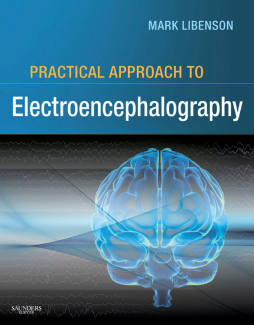 Practical Approach to Electroencephalography E-Book Practical Approach to Electroencephalography E-Book