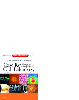 Case Reviews in Ophthalmology E-Book Case Reviews in Ophthalmology E-Book