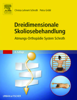 Dreidimensionale Skoliosebehandlung Dreidimensionale Skoliosebehandlung