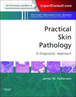 Practical Skin Pathology: A Diagnostic Approach E-Book Practical Skin Pathology: A Diagnostic Approach E-Book
