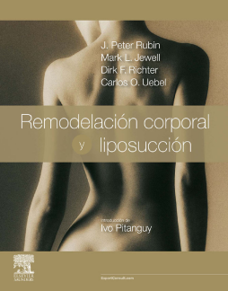 Remodelación corporal y liposucción + ExpertConsult Remodelación corporal y liposucción + ExpertConsult