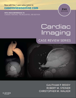 Cardiac Imaging: Case Review Series E-Book