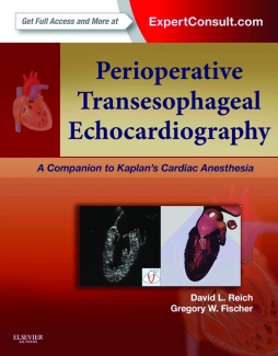 Perioperative Transesophageal Echocardiography E-Book Perioperative Transesophageal Echocardiography E-Book