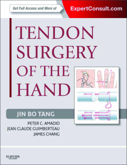 Tendon Surgery of the Hand E-Book Tendon Surgery of the Hand E-Book