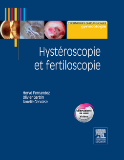 Hystéroscopie et fertiloscopie Hystéroscopie et fertiloscopie