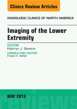 Imaging of the Lower Extremity, An Issue of Radiologic Clinics of North America, E-Book Imaging of the Lower Extremity, An Issue of Radiologic Clinics of North America, E-Book