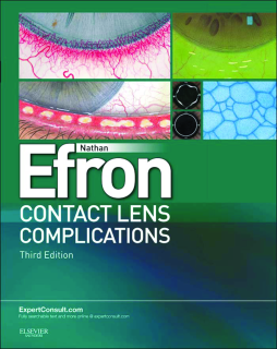 Contact Lens Complications E-Book Contact Lens Complications E-Book