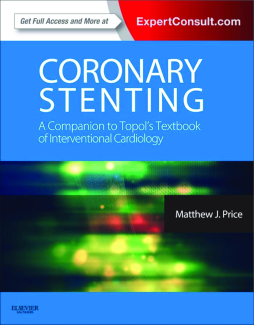 Coronary Stenting: A Companion to Topol's Textbook of Interventional Cardiology E-Book Coronary Stenting: A Companion to Topol's Textbook of Interventional Cardiology E-Book