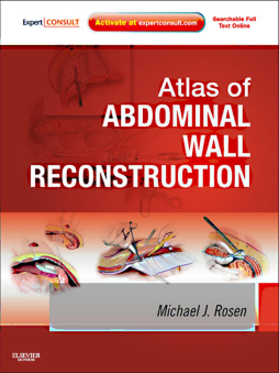 Atlas of Abdominal Wall Reconstruction E-Book Atlas of Abdominal Wall Reconstruction E-Book