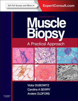 Muscle Biopsy E-Book Muscle Biopsy E-Book