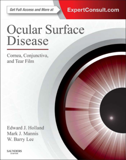 Doenças da Superfície Ocular Doenças da Superfície Ocular