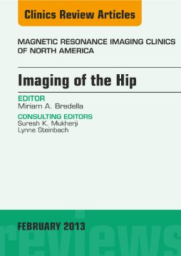 Imaging of the Hip, An Issue of Magnetic Resonance Imaging Clinics, E-Book Imaging of the Hip, An Issue of Magnetic Resonance Imaging Clinics, E-Book