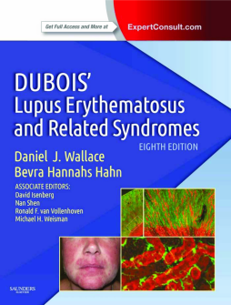 Dubois' Lupus Erythematosus and Related Syndromes E-Book Dubois' Lupus Erythematosus and Related Syndromes E-Book
