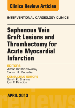Saphenous Vein Graft Lesions and Thrombectomy for Acute Myocardial Infarction, An Issue of Interventional Cardiology Clinics, E-Book Saphenous Vein Graft Lesions and Thrombectomy for Acute Myocardial Infarction, An Issue of Interventional Cardiology Clinics, E-Book