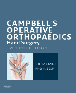 Campbell's Operative Orthopaedics: Hand Surgery E-Book Campbell's Operative Orthopaedics: Hand Surgery E-Book