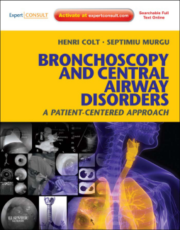 SPEC - Bronchoscopy and Central Airway Disorders E-Book