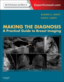 Making the Diagnosis: A Practical Guide to Breast Imaging E-Book Making the Diagnosis: A Practical Guide to Breast Imaging E-Book