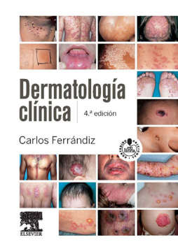 Dermatología clínica + StudentConsult en español Dermatología clínica + StudentConsult en español