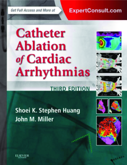Catheter Ablation of Cardiac Arrhythmias E-book Catheter Ablation of Cardiac Arrhythmias E-book