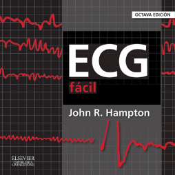 ECG fácil ECG fácil