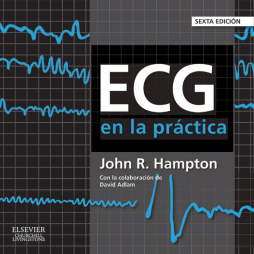 ECG en la práctica ECG en la práctica