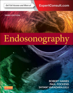 Ecoendoscopia Ecoendoscopia