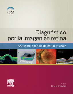 Diagnóstico por la imagen en retina Diagnóstico por la imagen en retina