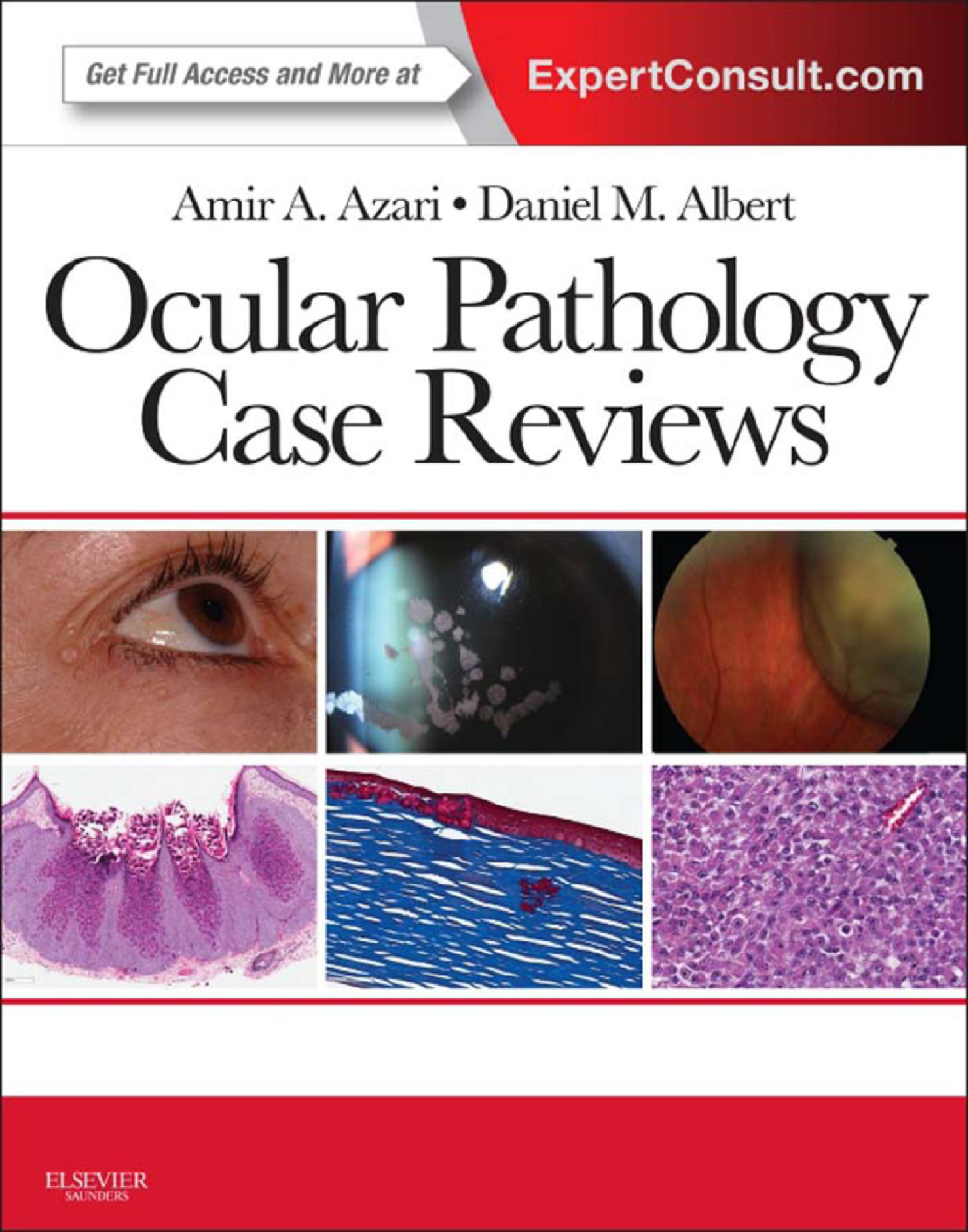 Ocular Pathology Case Reviews E-Book